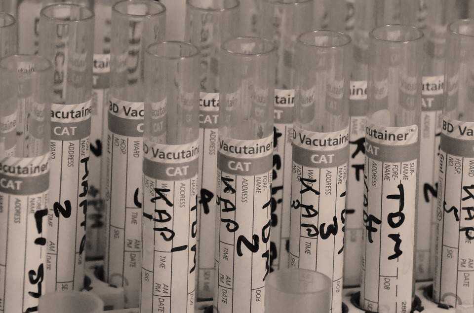 tests urinaires généraux 