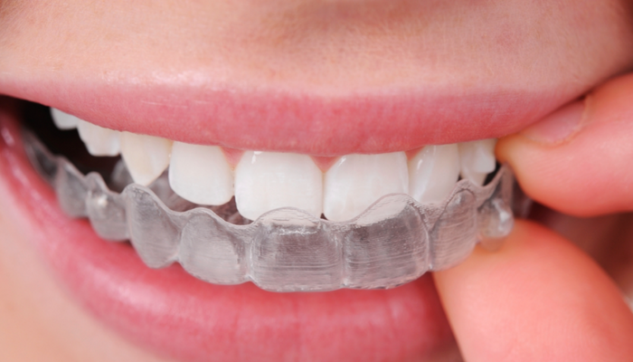 Dispositifs pour la bouche