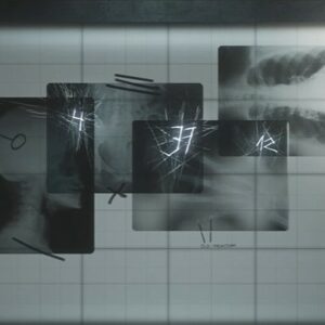 Soluce Puzzle radiographies Silent Hill 2 REMAKE-1