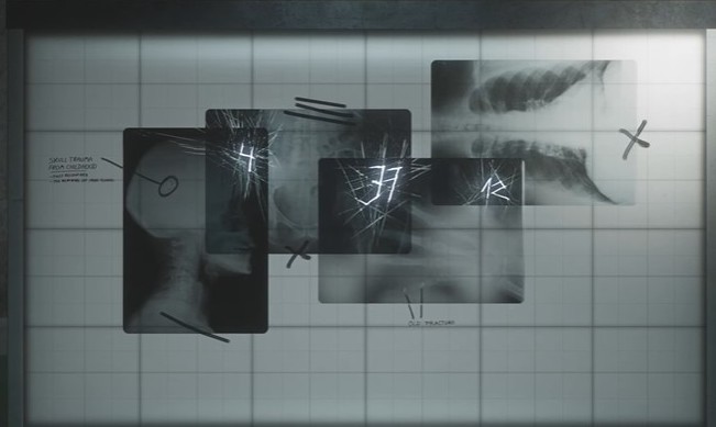 Soluce Puzzle radiographies Silent Hill 2 REMAKE-1