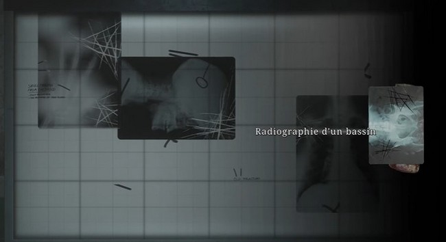 utiliser les radiographies dans l'énigme de Silent Hill 2 REMAKE